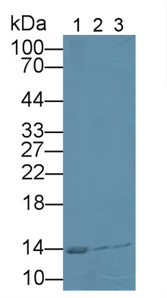 11915