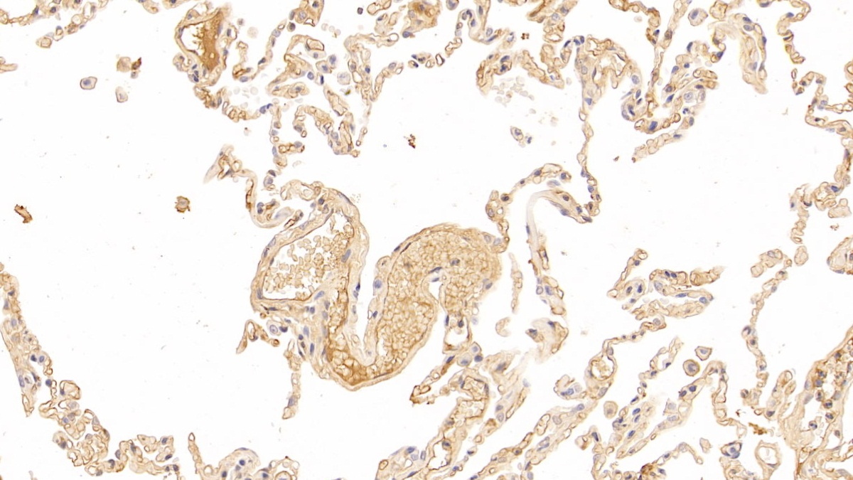 18890