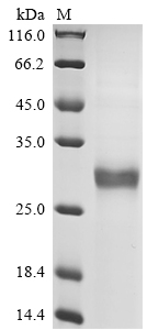 SDS-PAGE
