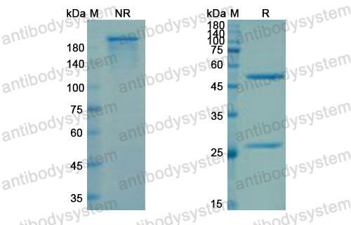 Валидация SDS-PAGE - AntibodySystem DHE43204