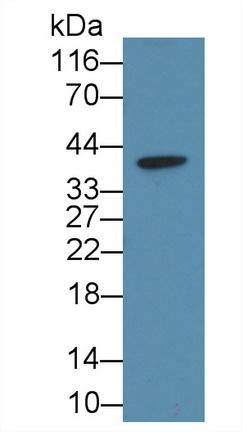 1704