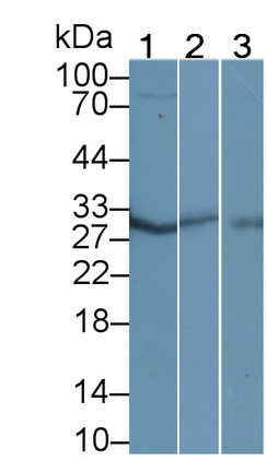 62738