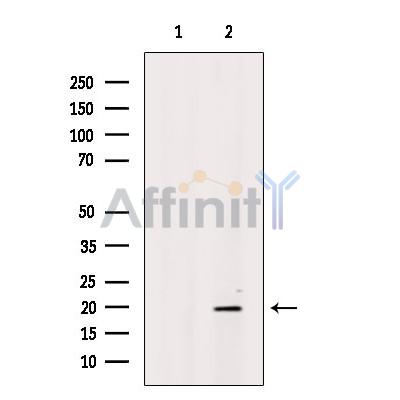 Валидация Affinity DF10023 - 5469
