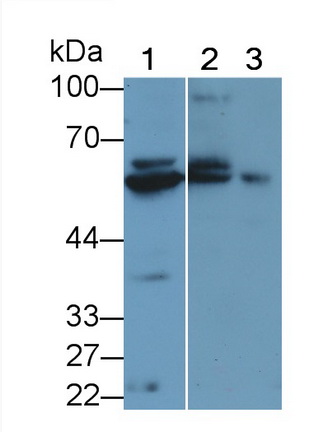20760