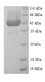 SDS-PAGE