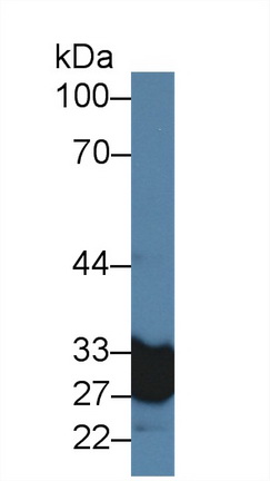14375