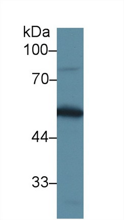 9170