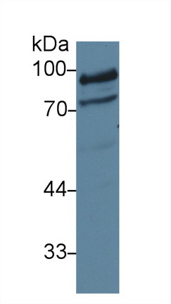13572