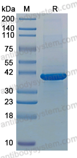 YVV46401, SDS-PAGE