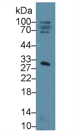 14644