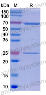 Валидация SDS-PAGE - AntibodySystem DHB86920
