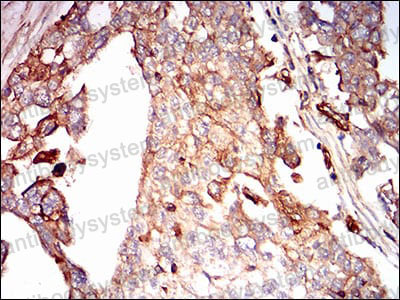 Валидация AntibodySystem RHD30802 (1464)
