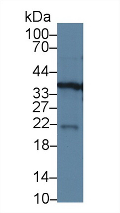 14712