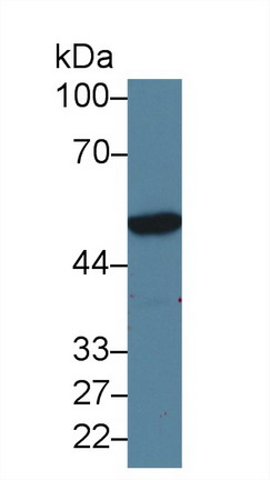 14248