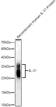 A24426, вестерн-блоттинг, рекомбинантный белок IL-31 человека (20060)
