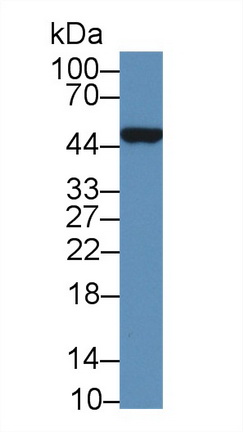 17615