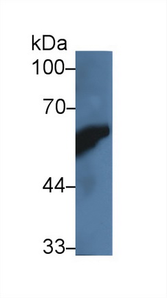 14007