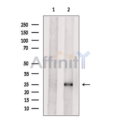 Валидация Affinity DF6027 - 17246