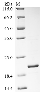 SDS-PAGE