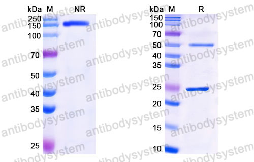 Валидация SDS-PAGE - AntibodySystem FMJ93040