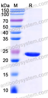 YHJ30303, SDS-PAGE