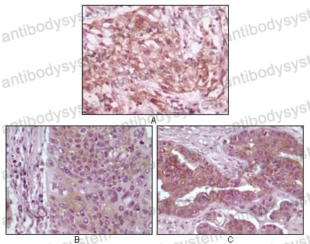Валидация AntibodySystem RHG57904
