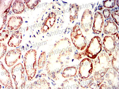 Валидация AntibodySystem RHG85602 (3094)