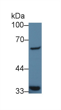 13972