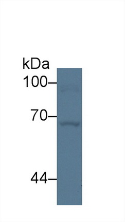 14277