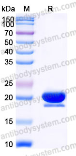 YHD19702, SDS-PAGE