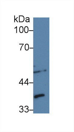 14232