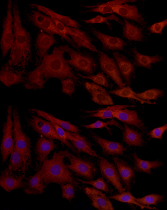 A0434, иммунофлуоресценция, клетки C6 (1022)