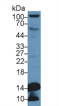 17695