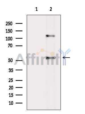 Валидация Affinity DF3597 - 14561