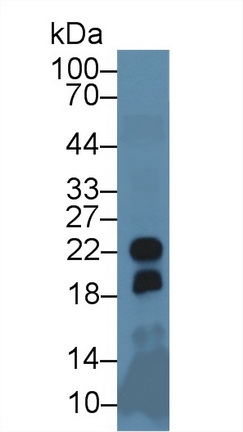 13892