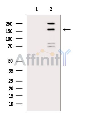 Валидация Affinity DF13896 - 9630