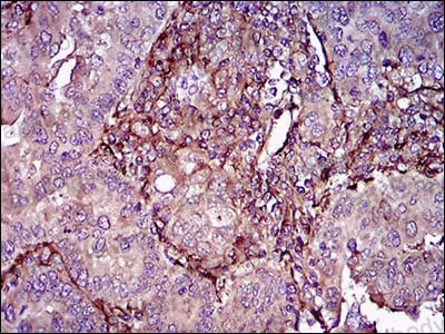 Валидация AntibodySystem RHC07802 (596)