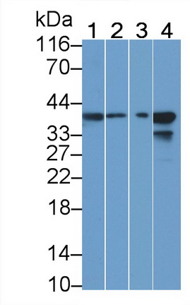 23817