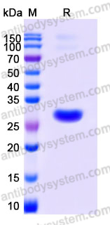 YHD86001, SDS-PAGE