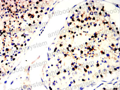 Валидация AntibodySystem RHN99202 (4043)