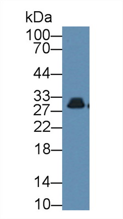 11912