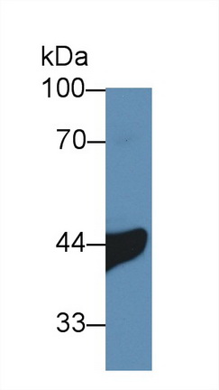 12379