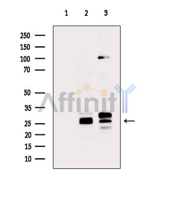 Валидация Affinity DF13872 - 9595