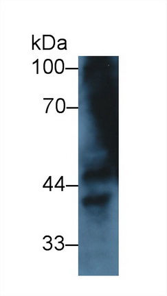 14217