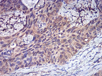 Валидация AntibodySystem RHN95202 (3990)