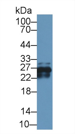 14161