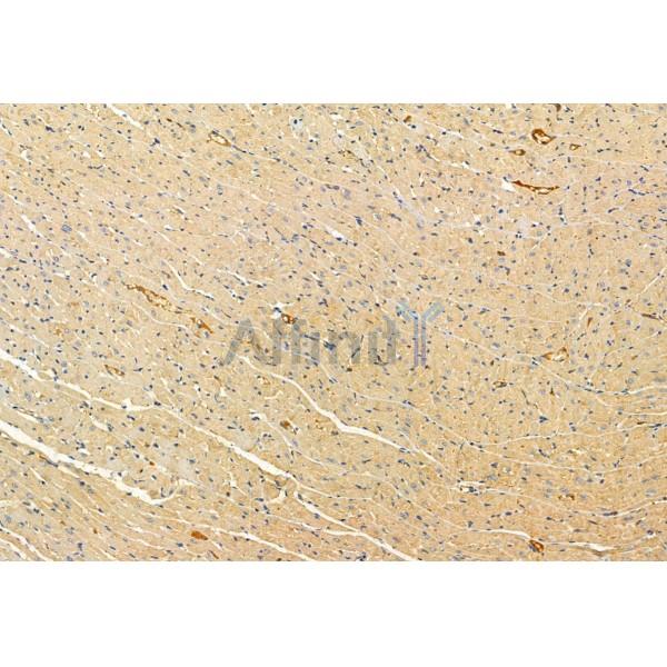 Валидация Affinity DF12024 - 6045