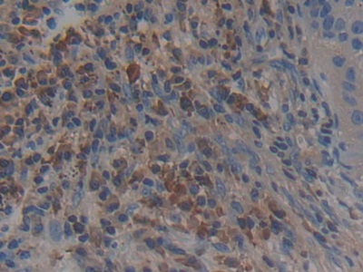 16882