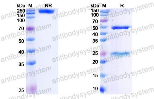 Валидация SDS-PAGE - AntibodySystem FHK17830
