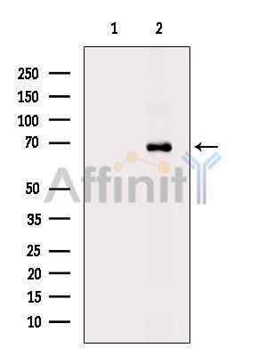 Валидация Affinity DF15205 - 11473